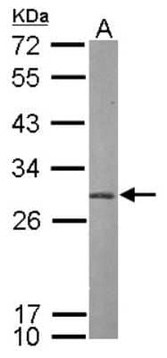 Western Blot: PSMA7 Antibody [NBP1-33539]
