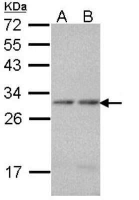 Western Blot: PSMA7 Antibody [NBP1-33539]