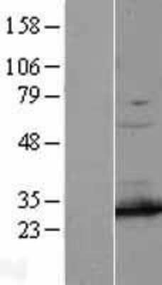 Western Blot: PSMA7 Overexpression Lysate [NBL1-14875]