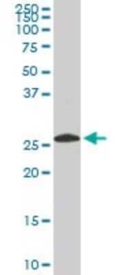 Western Blot: PSMA8 Antibody (2E3) [H00143471-M03]