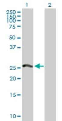 Western Blot: PSMA8 Antibody [H00143471-D01P]