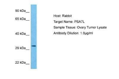 Western Blot: PSMA8 Antibody [NBP2-86758]