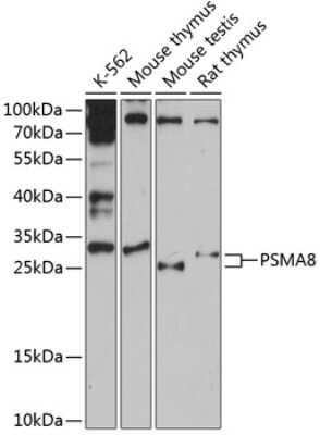 Western Blot: PSMA8 AntibodyAzide and BSA Free [NBP2-93338]