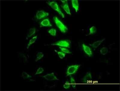 Immunocytochemistry/ Immunofluorescence: PSMB10/MECL1 Antibody (3F8) [H00005699-M01]