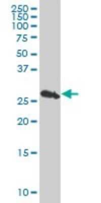 Western Blot: PSMB10/MECL1 Antibody (3F8) [H00005699-M01]