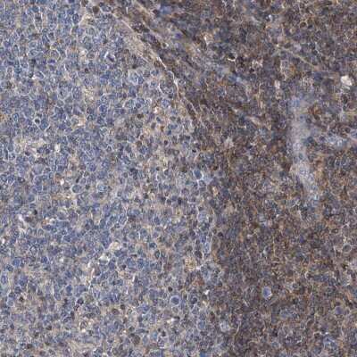 Immunohistochemistry: PSMB10/MECL1 Antibody [NBP2-38155]