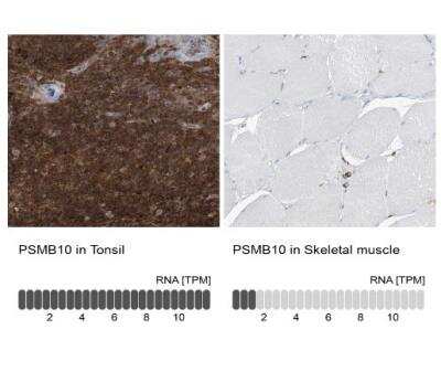 Immunohistochemistry-Paraffin: PSMB10/MECL1 Antibody [NBP1-88660]