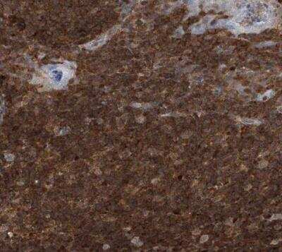 Immunohistochemistry-Paraffin: PSMB10/MECL1 Antibody [NBP1-88660]