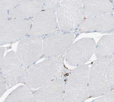 Immunohistochemistry-Paraffin: PSMB10/MECL1 Antibody [NBP1-88660]