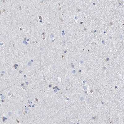 Immunohistochemistry-Paraffin: PSMB10/MECL1 Antibody [NBP2-38155]