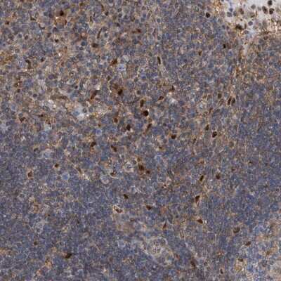 Immunohistochemistry-Paraffin: PSMB10/MECL1 Antibody [NBP2-38155]