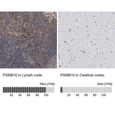 Immunohistochemistry-Paraffin: PSMB10/MECL1 Antibody [NBP2-38155]