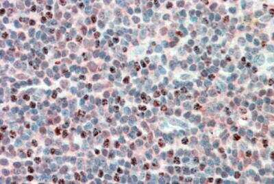 Immunohistochemistry-Paraffin: PSMB10/MECL1 Antibody [NBP1-51958]