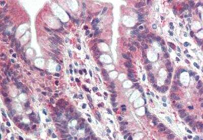 Immunohistochemistry-Paraffin: PSMB10/MECL1 Antibody [NBP1-51958]