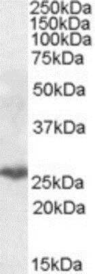 Western Blot: PSMB10/MECL1 Antibody [NBP1-51958]