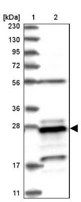 Western Blot: PSMB10/MECL1 Antibody [NBP1-88660]