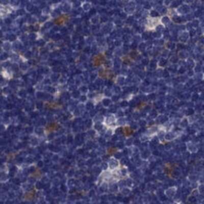 Immunohistochemistry-Paraffin: PSMB11 Antibody [NBP2-68605]