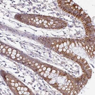 Immunohistochemistry-Paraffin: PSMB11 Antibody [NBP2-34158]