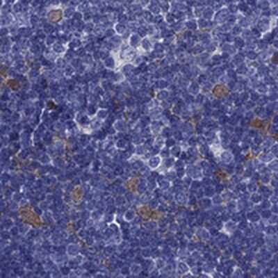 Immunohistochemistry-Paraffin: PSMB11 Antibody [NBP2-34158]