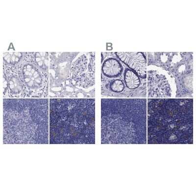 Immunohistochemistry-Paraffin: PSMB11 Antibody [NBP2-34158]