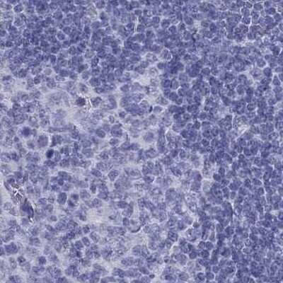 Immunohistochemistry-Paraffin: PSMB11 Antibody [NBP2-34158]