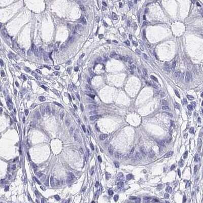 Immunohistochemistry-Paraffin: PSMB11 Antibody [NBP2-34158]
