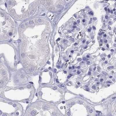 Immunohistochemistry-Paraffin: PSMB11 Antibody [NBP2-34158]