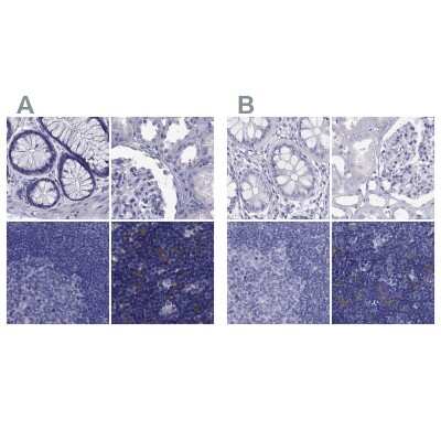 Immunohistochemistry-Paraffin: PSMB11 Antibody [NBP2-68605]