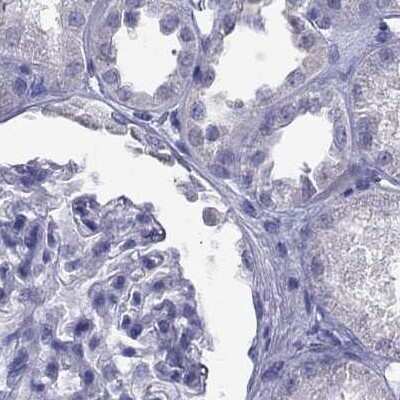 Immunohistochemistry-Paraffin: PSMB11 Antibody [NBP2-68605]
