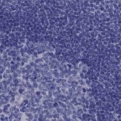 Immunohistochemistry-Paraffin: PSMB11 Antibody [NBP2-68605]