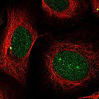 Immunocytochemistry/ Immunofluorescence: PSMB5 Antibody [NBP2-57323]