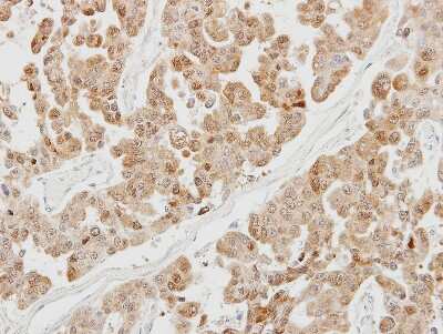 Immunohistochemistry-Paraffin: PSMB5 Antibody [NBP2-19983]