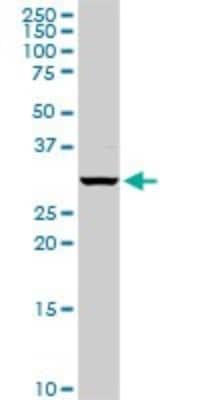 Western Blot: PSMB5 Antibody [H00005693-D01P]