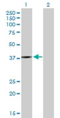Western Blot: PSMB5 Antibody [H00005693-D01P]