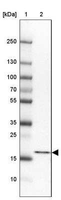 Western Blot: PSMB5 Antibody [NBP2-13820]