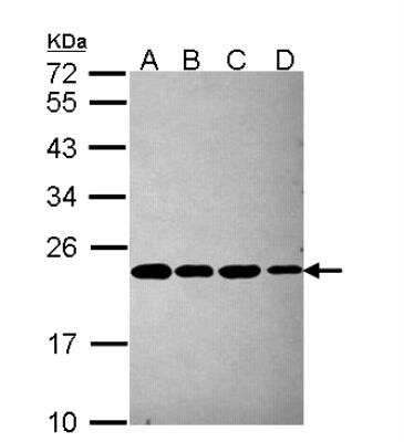 Western Blot: PSMB5 Antibody [NBP2-19983]