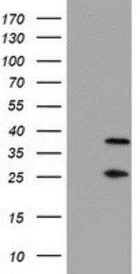 Western Blot: PSMB7 Antibody (OTI1E1)Azide and BSA Free [NBP2-73645]