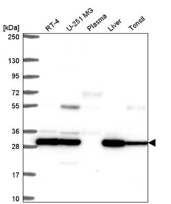 Western Blot: PSMB7 Antibody [NBP2-58648]