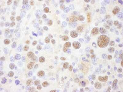 Immunohistochemistry-Paraffin: PSMC1 Antibody [NBP2-14857]