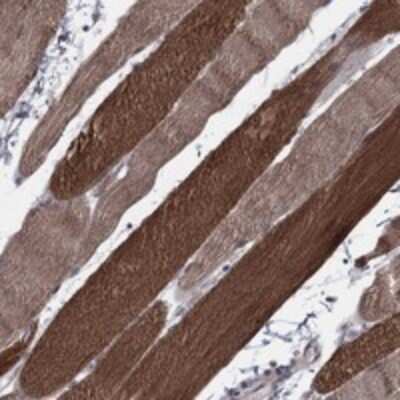 Immunohistochemistry-Paraffin: PSMC1 Antibody [NBP3-17916]
