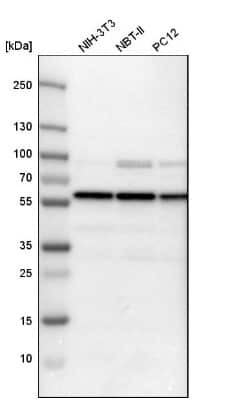 Western Blot: PSMC1 Antibody [NBP1-80959]