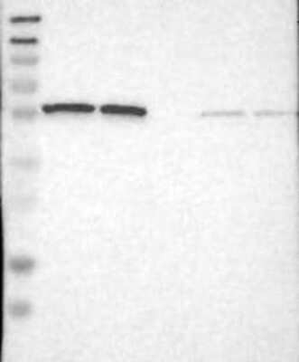 Western Blot: PSMC1 Antibody [NBP3-17916]