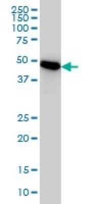 Western Blot: PSMC3 Antibody (1B9) [H00005702-M01]