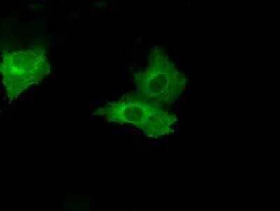 Immunocytochemistry/ Immunofluorescence: PSMC3 Antibody (OTI9F3) - Azide and BSA Free [NBP2-73696]