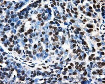Immunohistochemistry: PSMC3 Antibody (OTI9F3) - Azide and BSA Free [NBP2-73696]