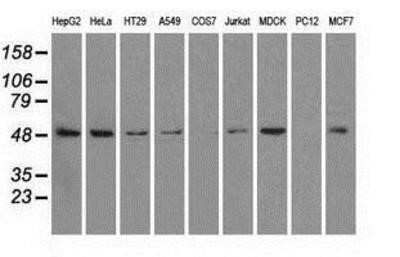 Western Blot: PSMC3 Antibody (OTI9F3)Azide and BSA Free [NBP2-73696]