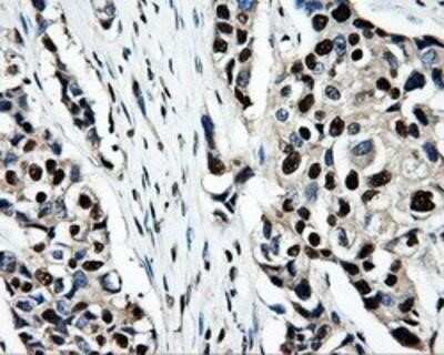 Immunohistochemistry-Paraffin: PSMC3 Antibody (OTI9F3) [NBP2-02316]