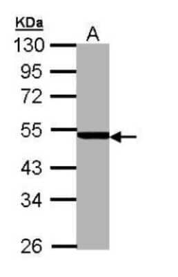 Western Blot: PSMC3 Antibody [NBP1-32749]