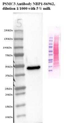 Western Blot: PSMC3 Antibody [NBP1-86962]