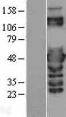 Western Blot: PSMC3 Overexpression Lysate [NBL1-14888]